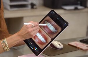 Dr. Leone using a tablet to illustrate a patient’s veneer treatment plan, showcasing a digital before-and-after preview.